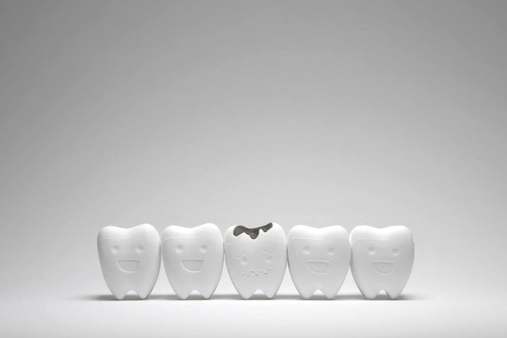 Five tooth models. 4 are smiling and intact. One has a cavity and is sad.